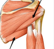 <p>What is the Name of this muscle?</p>