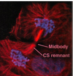 <ul><li><p>Telophase- you can see the actin is starting to constrict it an dits not a fully cut so its not cyokenisis&nbsp;</p></li></ul><p></p>