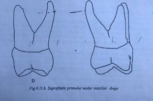 <p>-orientare convergenta (osszetarto)  =  dinspre oclucal-inspre colet,si</p><p>sens vesibulo-palainal</p><p>- forma trapez,latura mare spre Lin. Colet</p><p></p>