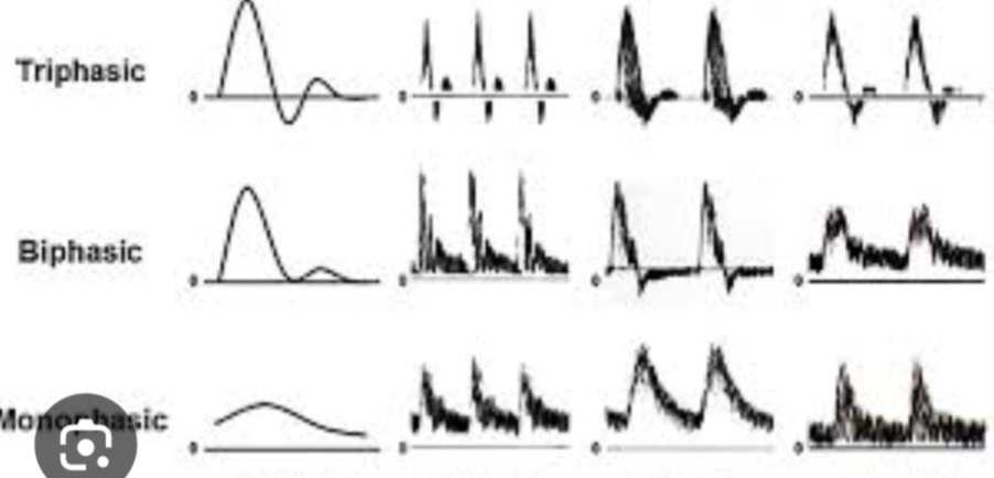 <p>Waveforms with 3 distinct points, like high resistant waveforms. These are found in the legs and arms </p><p>Legs- ( femoral artery, popliteal artery, dorsal pedis artery ( top of the foot), anterior tibial artery </p><p>Arms- radial and ulnar artery </p>