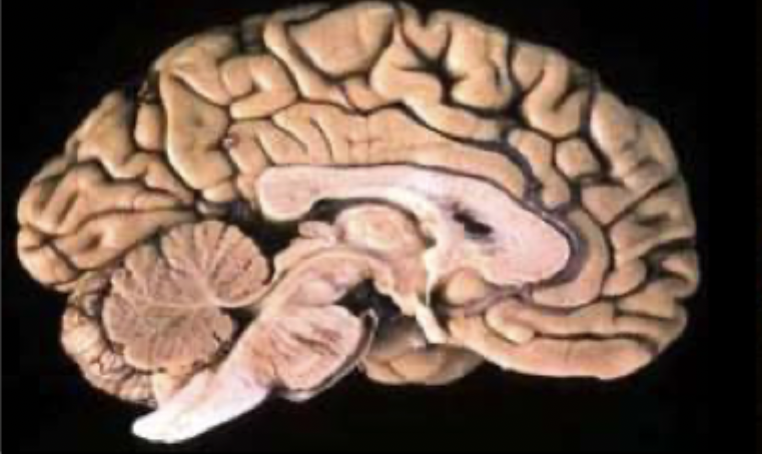 <p>What is the C shaped structure in the centre of the cerebrum?</p>
