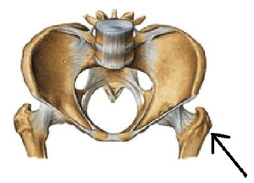 <p>trochantor major</p>