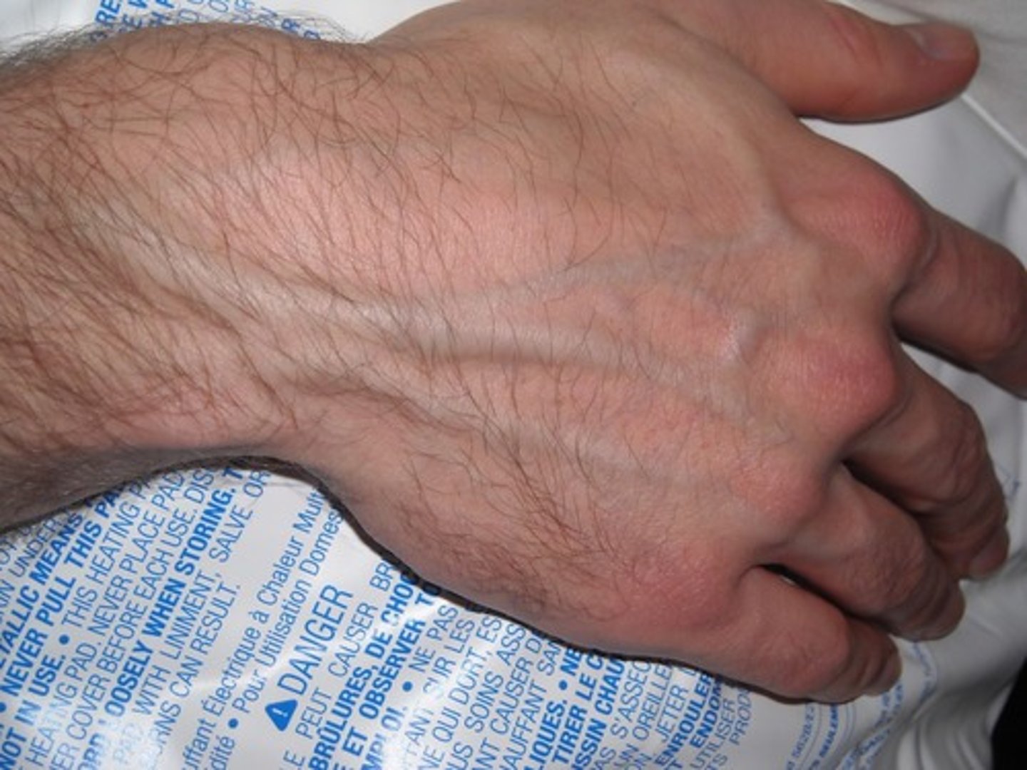 <p>vein</p>