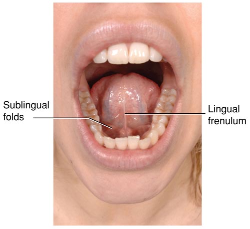 <p>lingual frenulum</p>