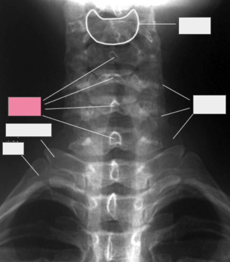 <p>What structure of the spine does the box highlighted in pink reference to?</p>