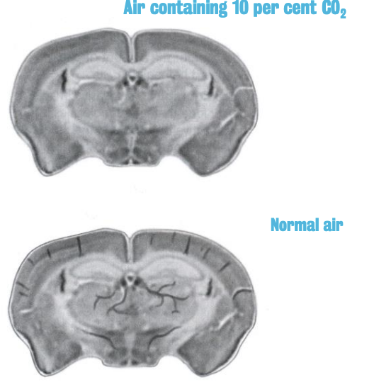 <p>In this image, what does the dark vein effect in the bottom slice reflect?</p>