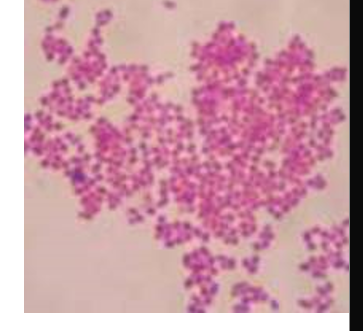 <ul><li><p>GN coccus</p></li><li><p>NF of the mouth and nasopharynx</p></li><li><p>implicated in cases of osteomyelitis and endocarditis </p></li><li><p>polymicrobic infection </p></li></ul><p></p>