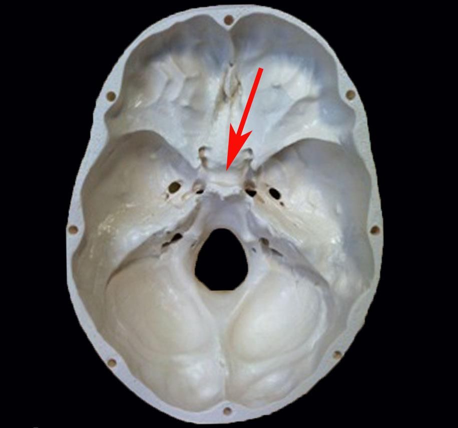 <p>depression in middle of sphenoid bone (pituitary gland sits in it)</p>