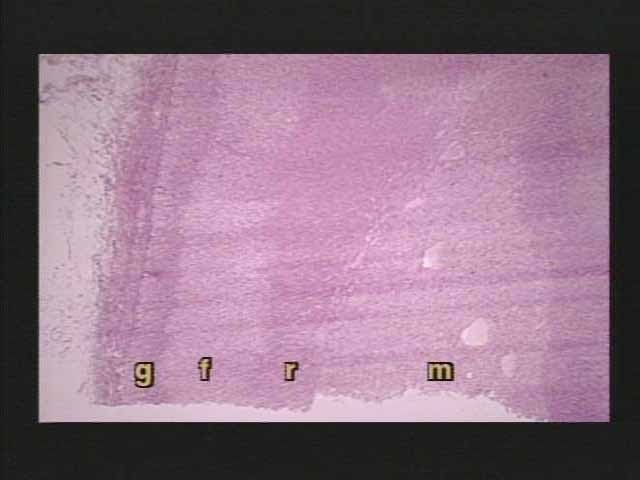 <p>What do the letters g-f-r-m label here?</p>