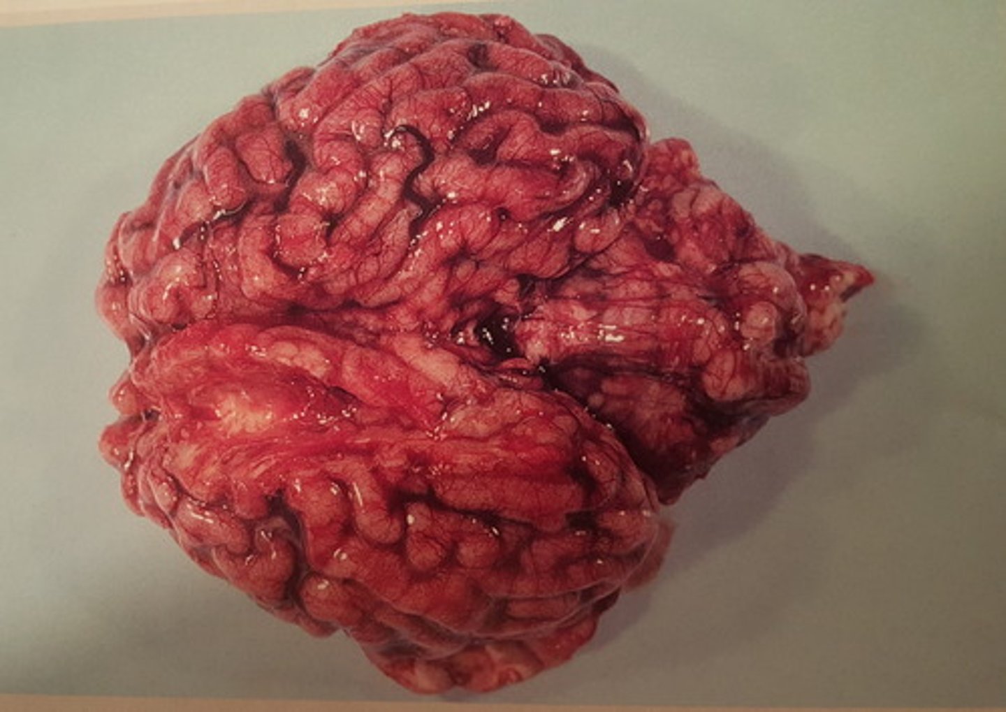 <p>Hjerne fra okse. Patoanatomisk diagnose?</p>