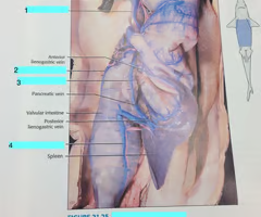 <p>posterior intestinal vein</p>