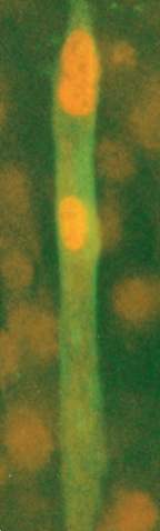 <p>MyoD is artificially expressed in fibroblasts</p><p>the fibroblasts start to behave as myoblasts, fuse to form muscle-like cells</p><p>meaning: fibroblasts already contain other transcriptional regulators required for combinatorial induction of terminal muscle fate; addition of MyoD completes a unique combination for muscle cells</p><p><strong>summarized: </strong>fibroblasts and myoblasts have the same transcription initiation complex, except for MyoD, which is what differentiates myoblasts from fibroblasts</p><p>(other cell types not related to muscle cells do not respond the same way)</p><p>(in the picture, the yellow is muscle-specific proteins detected by a stain in fibroblasts)</p>