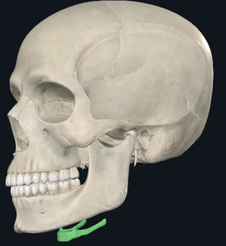 term image