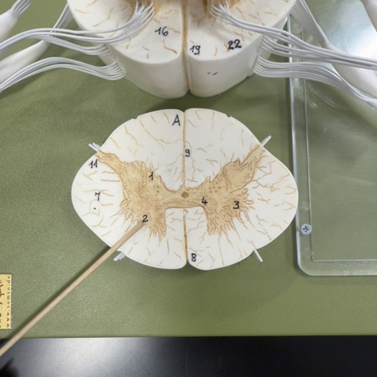 <p>Identify the structure.</p>