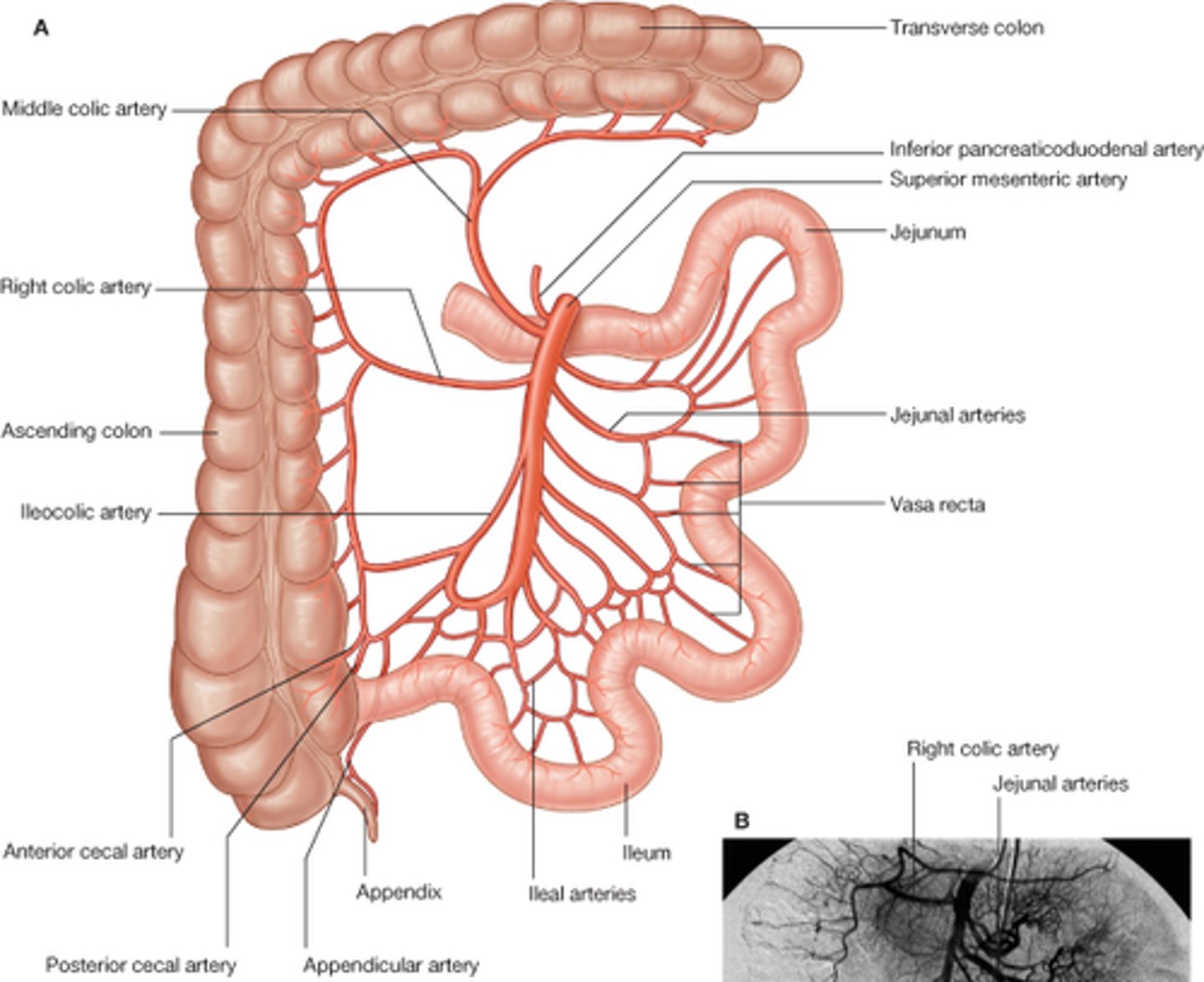 <p>ileum and cecum</p>