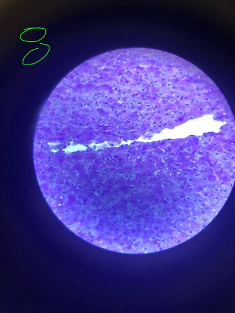 <p>What stain is this?</p>