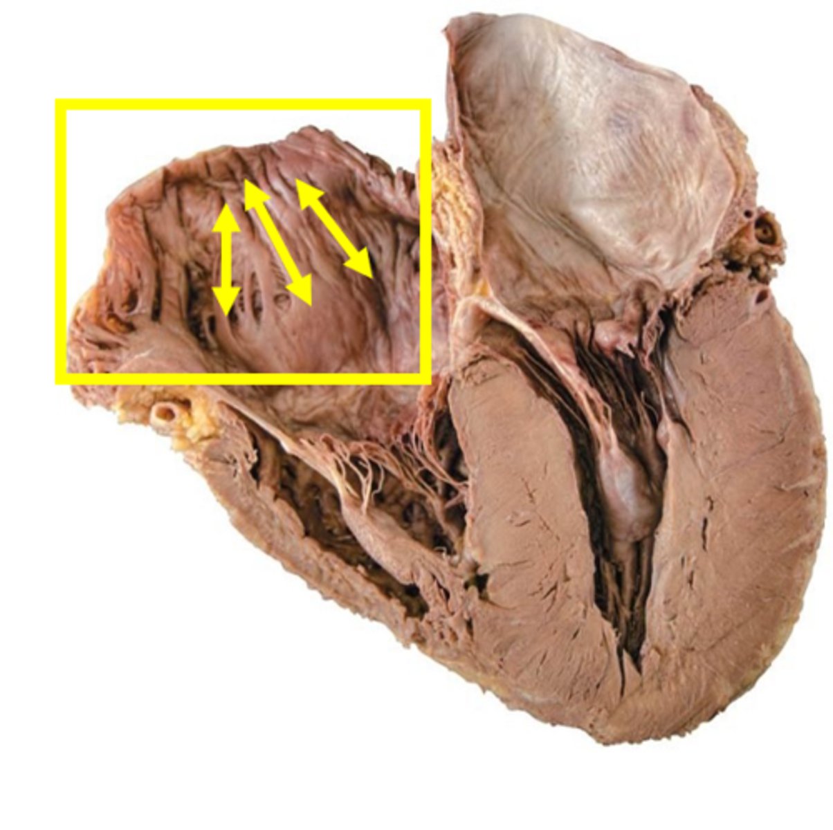 <p>Name these ridges.</p>