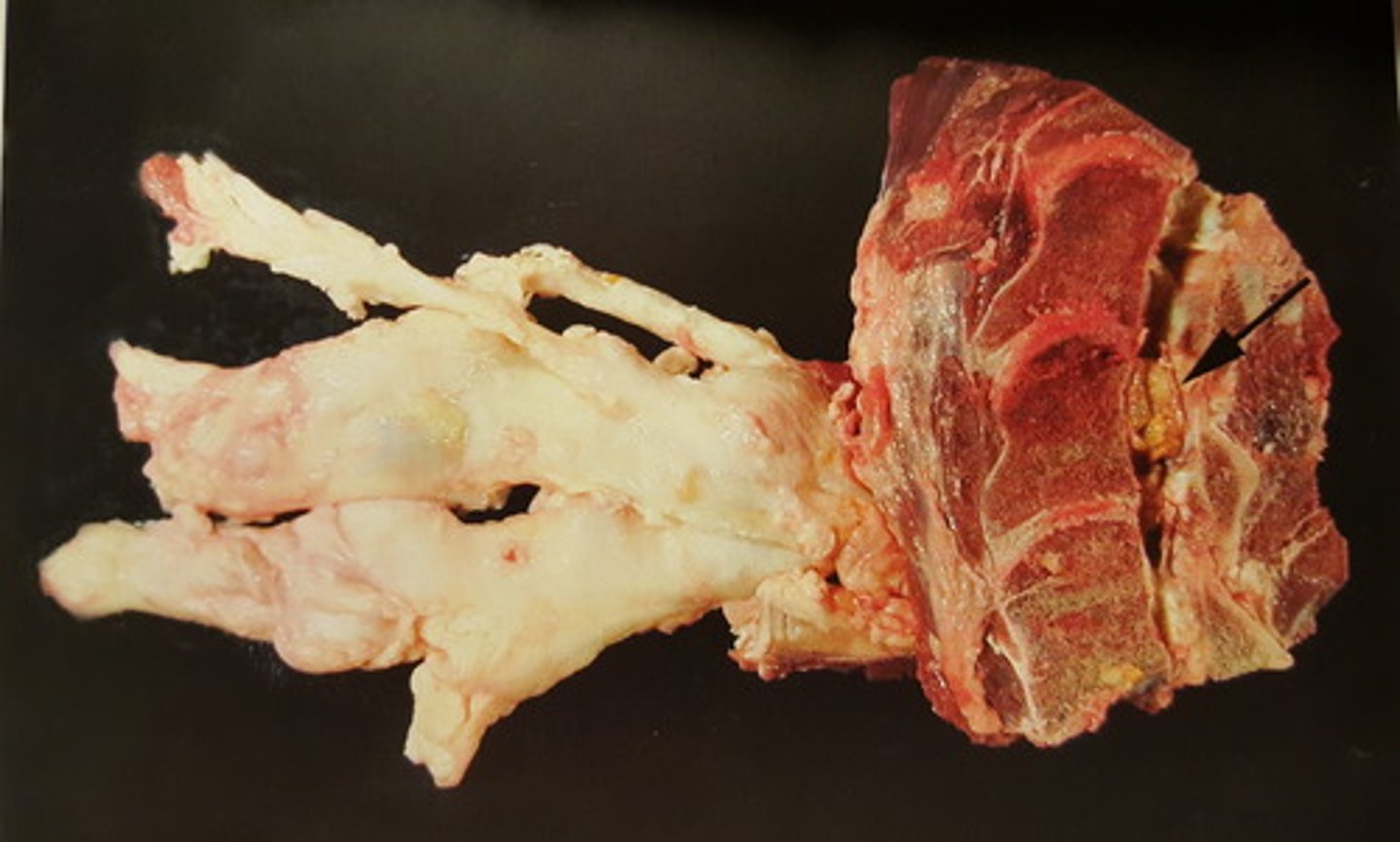 <p>Perifere nervesystem hos okse. Patoanatomisk diagnose?</p>