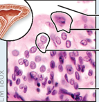 <p>transitional epithelium</p>