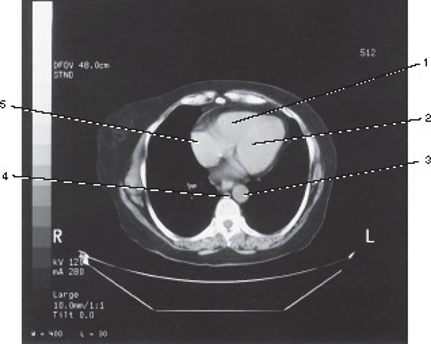 <p>What algorithm, matrix size, and section thickness were used for this image?</p>