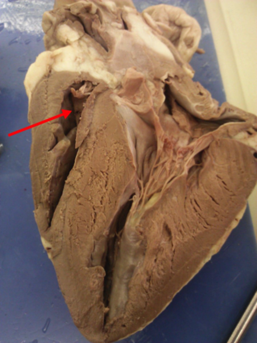 <p>What is red arrow</p>