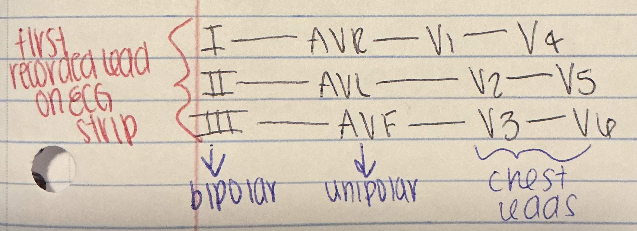<p>I, II, III — aVR, aVL, aVF — V1, V2, V3 — V4, V5, V6</p>