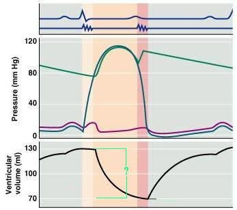 <p><span><span>What cardiac cycle volume is indicated on the diagram?</span></span></p>