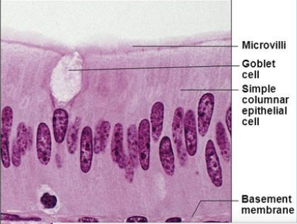<p>columnar </p>