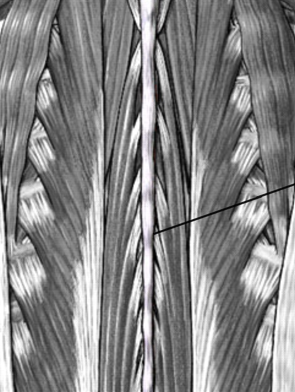 <p>Which ligament of the intervertebral is inferior to&nbsp;ligamentum nuchae and attach at tip of spinous?</p>