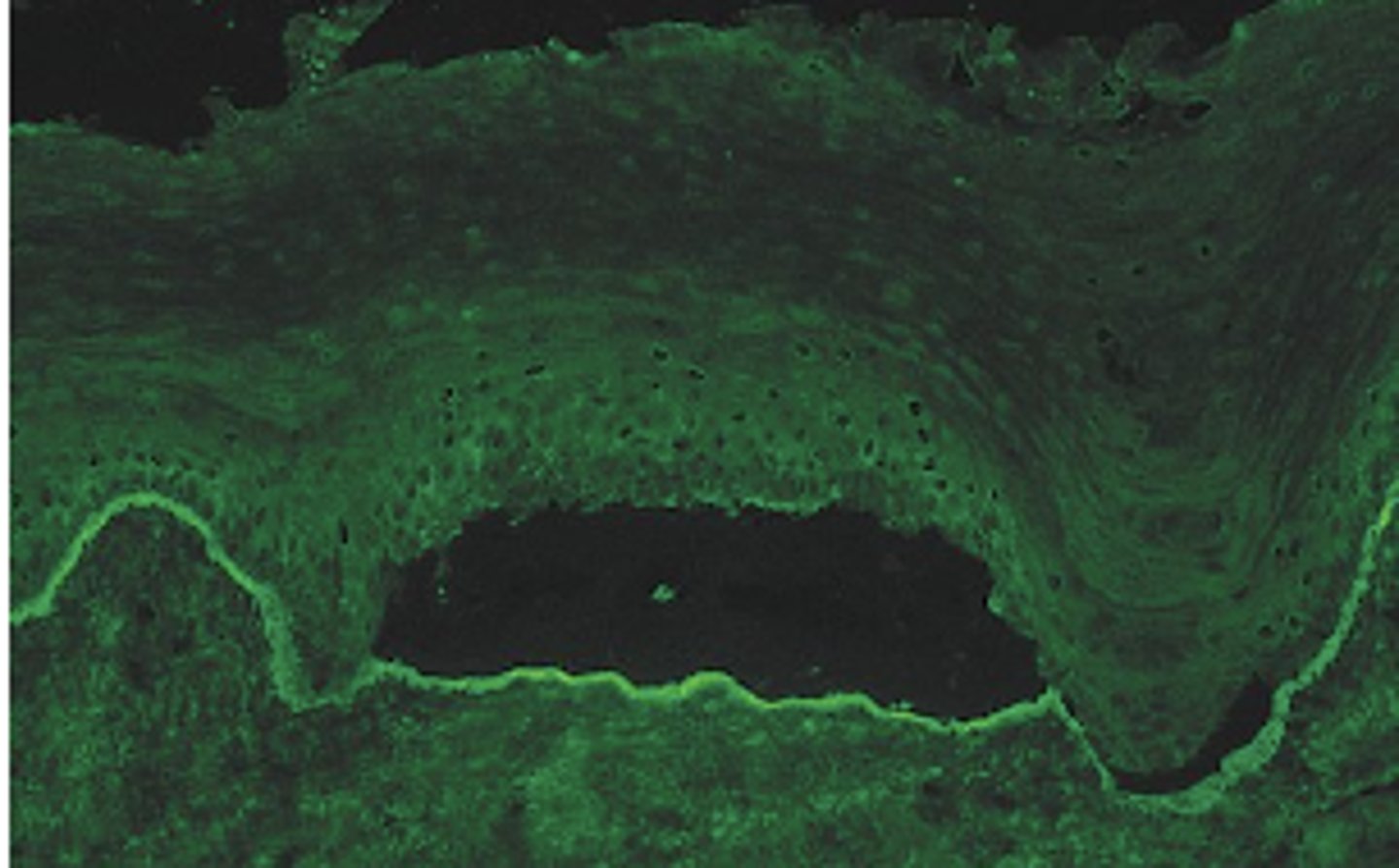 <p>What kind of doctor would you refer a patient with</p><p>pemphigoid?</p>