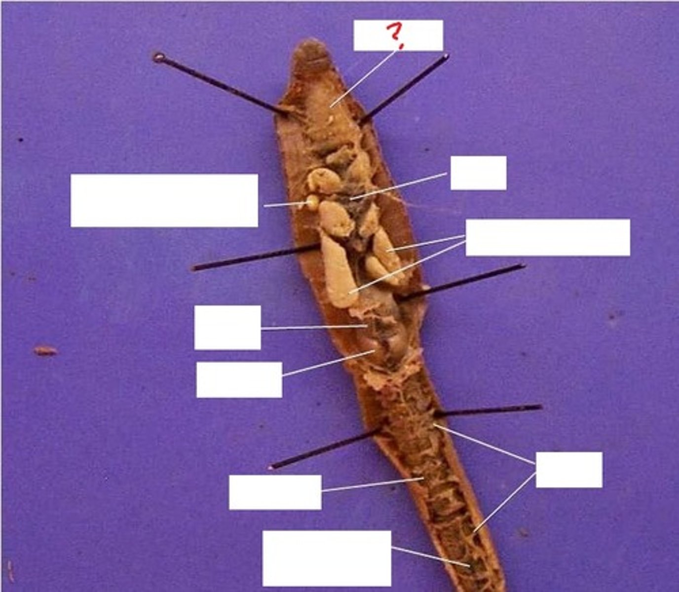 <p>What organ is this and what is it's function?</p>