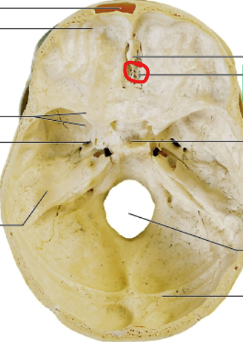<p>olfactory nerves sits here</p>