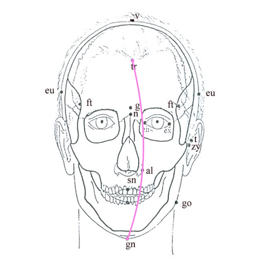 <p>trichion-gnathion (tr-gn)</p>