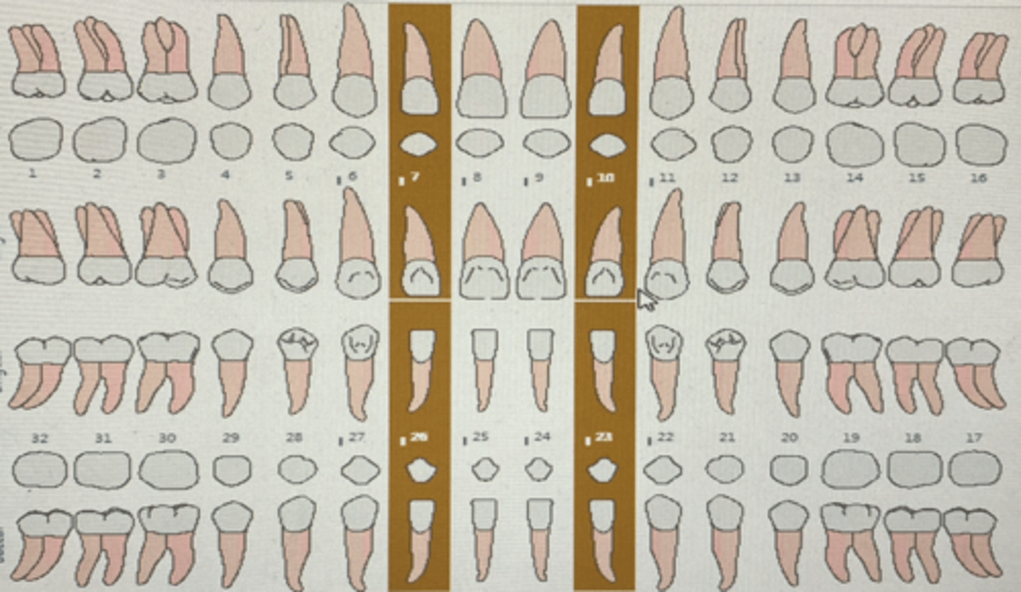 knowt flashcard image