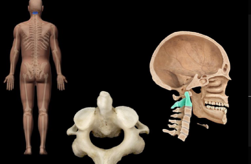 <p>What bone in the vertebral column is highlighted in this image?</p>