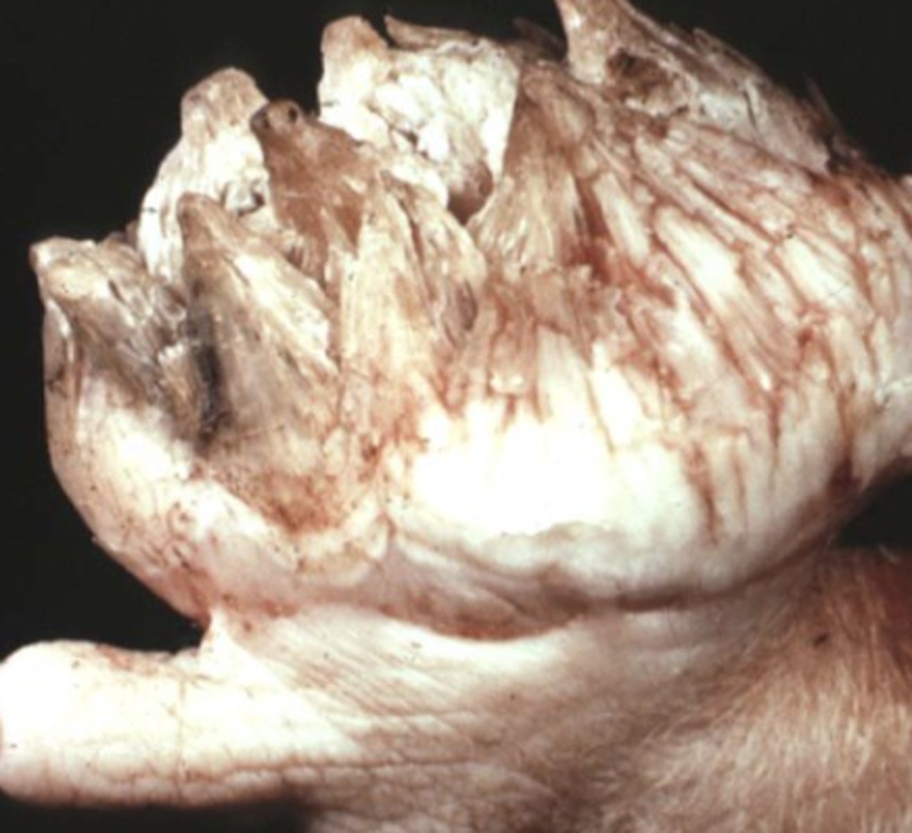 <p>What kind of tumor is this?</p>