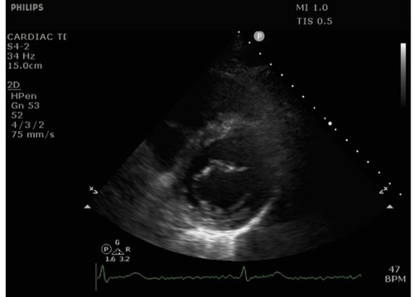 <p>what view is this?</p>