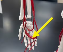 <p>Name the blood vessel.</p>