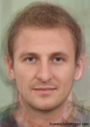 <p>Identify this Phenotype</p>