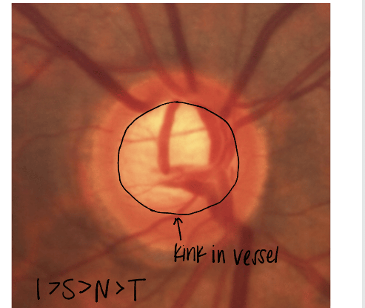 <p>Does this nerve follow the ISNT rule?</p>