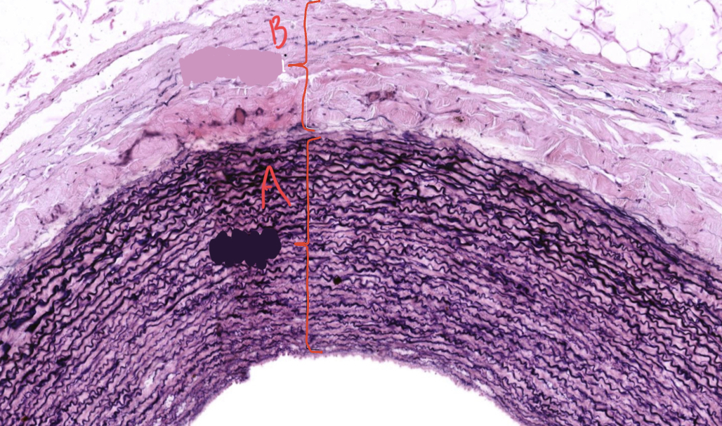 This is an image of ? What is A and B