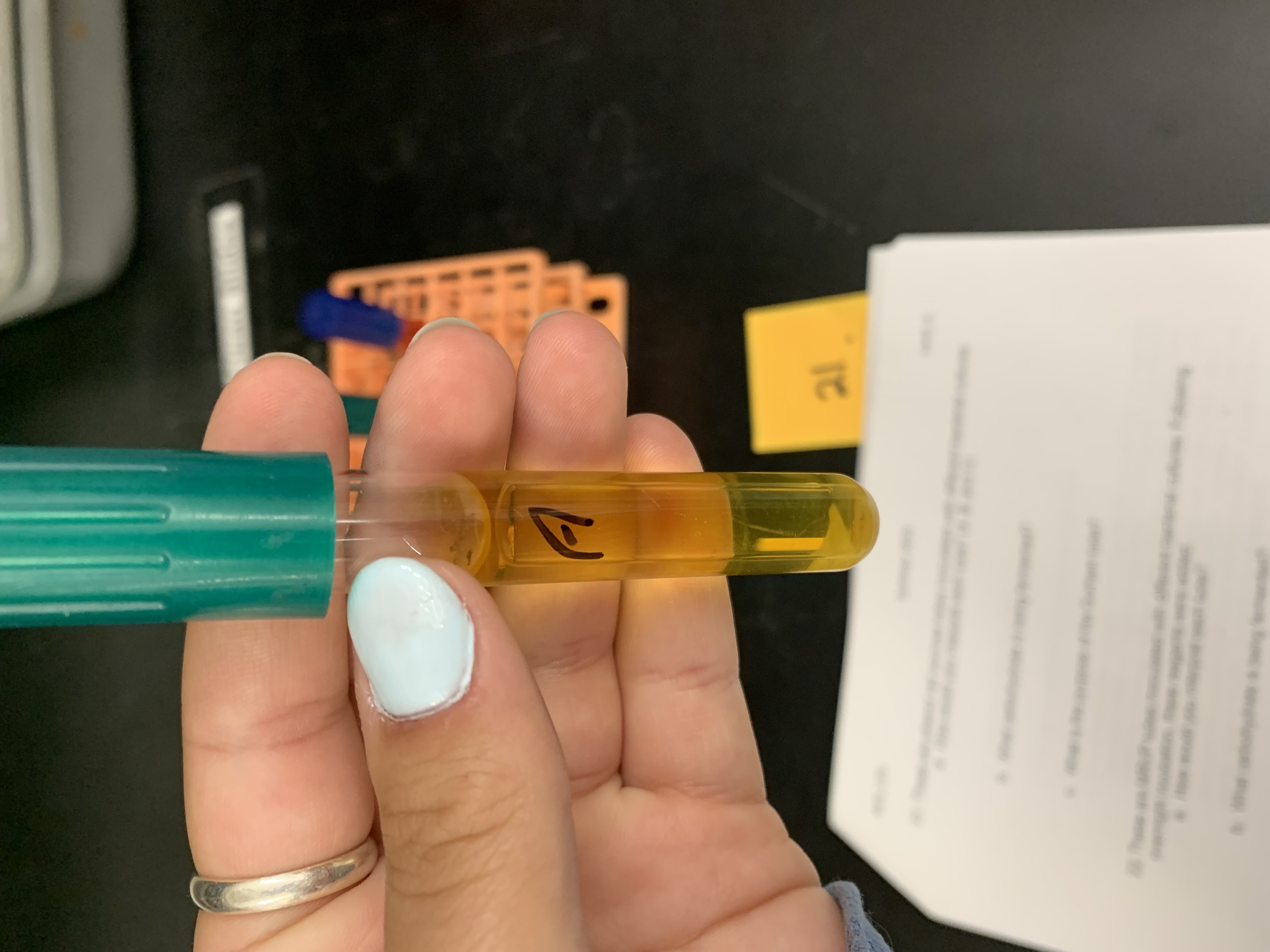 <p>(Phenol red sucrose tube) interpret the tube</p>