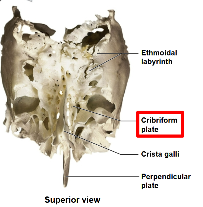 <p>What bone is this?</p>