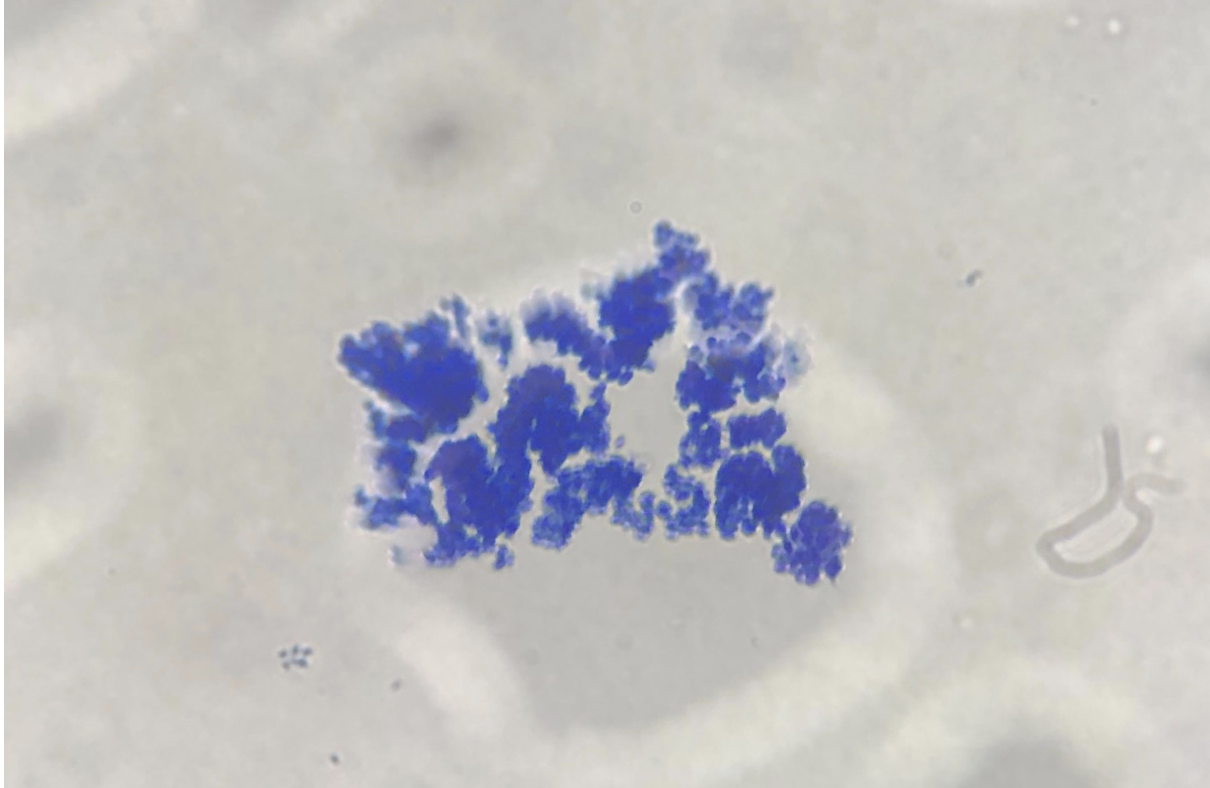 Saccharomyces cerevisiae 