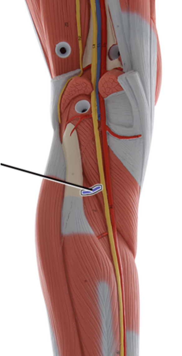 <p>Name this artery.</p>