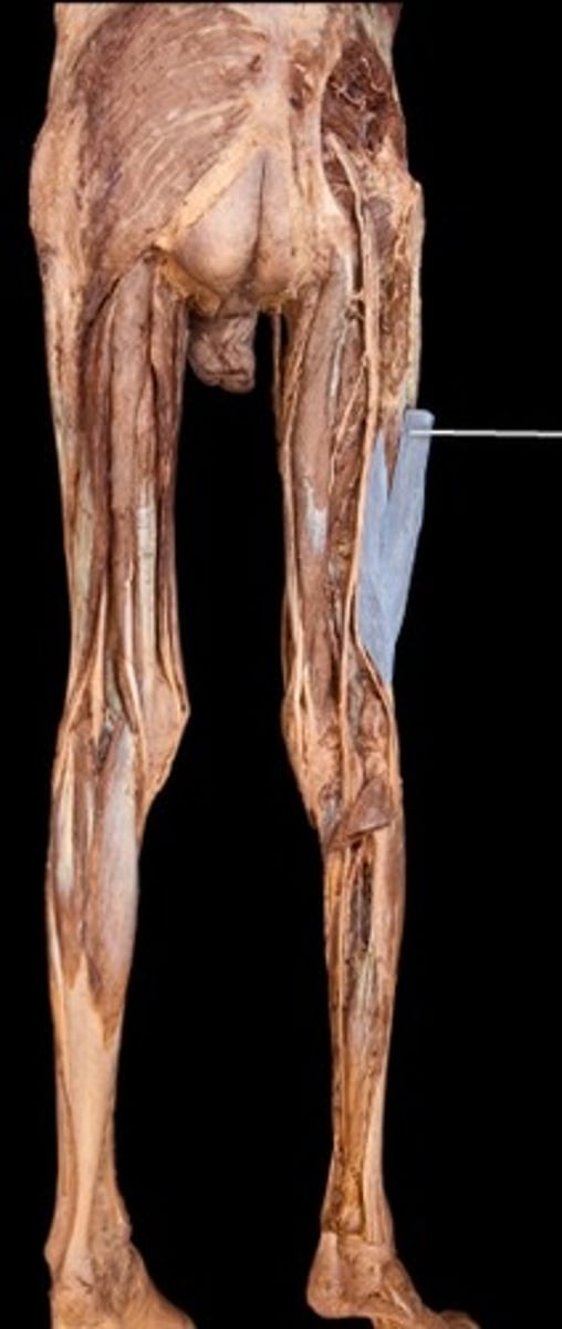 <p>What muscle is this?</p>