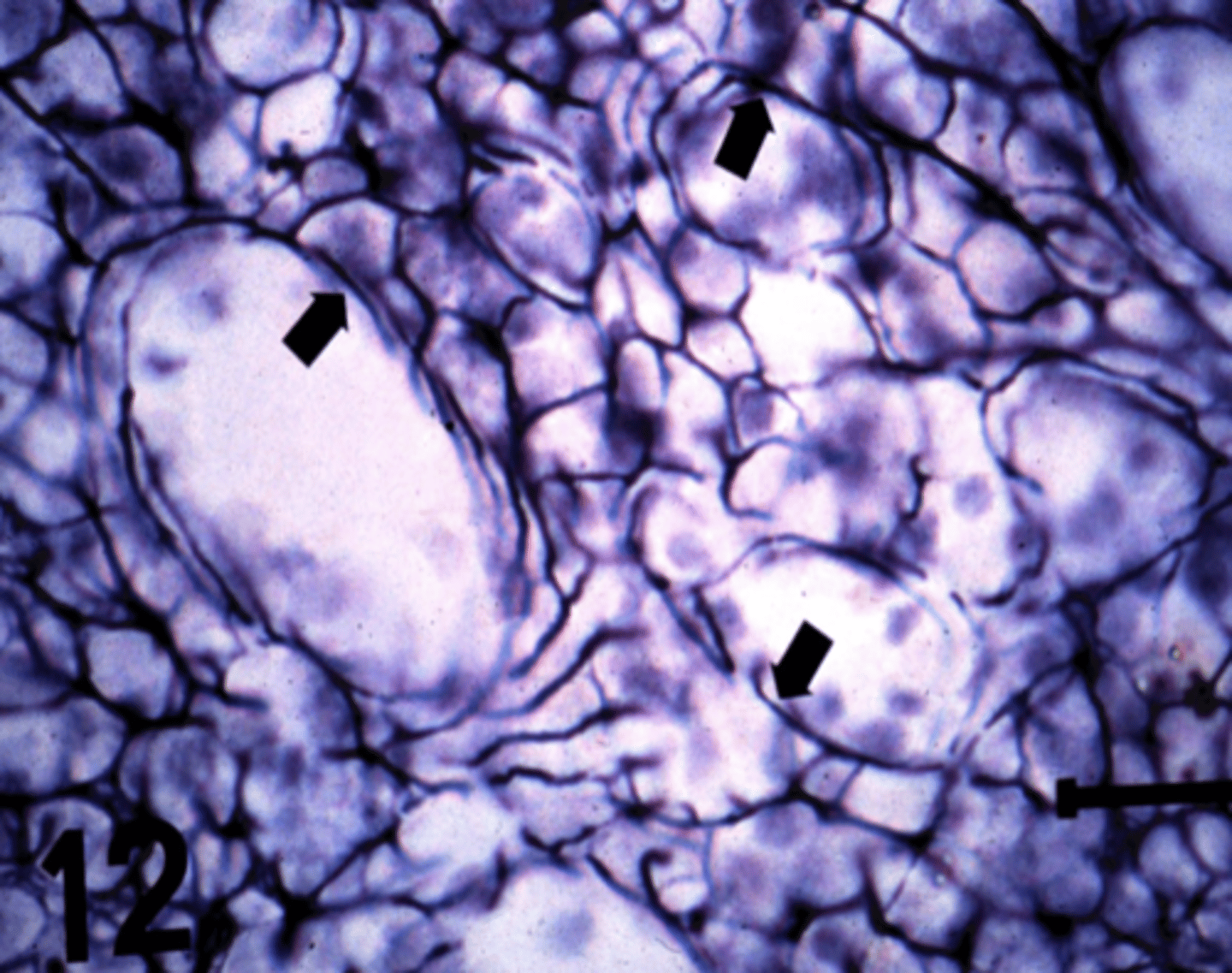 <p>What type of connective tissue is demonstrated in this image?</p>