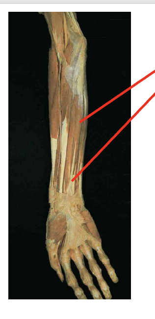 <p>What is this. muscle? where does it insert? Waht is its origin </p>