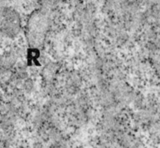 <p>primarily make proteins for the cell itself</p>