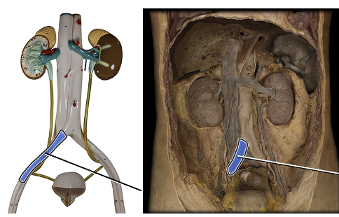 <p>supplies blood to leg</p>